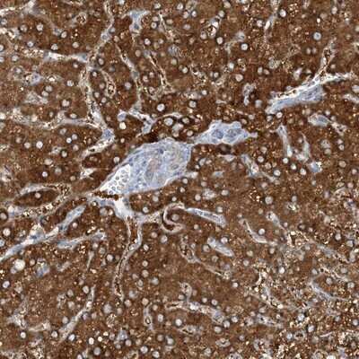 Immunohistochemistry-Paraffin: MRPS18A Antibody [NBP1-83849]