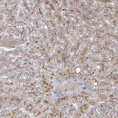 Immunohistochemistry-Paraffin: MRPS18A Antibody [NBP1-83850]