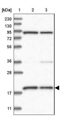 Western Blot: MRPS18A Antibody [NBP1-83849]