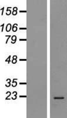 Western Blot: MRPS18A Overexpression Lysate [NBP2-06869]