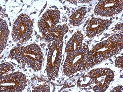 Immunohistochemistry-Paraffin: MRPS18B Antibody [NBP2-15024]