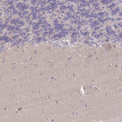 Immunohistochemistry-Paraffin: MRPS18B Antibody [NBP2-48958]