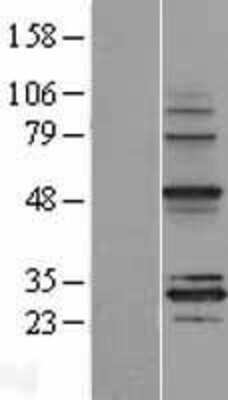 Western Blot: MRPS18B Overexpression Lysate [NBL1-13289]