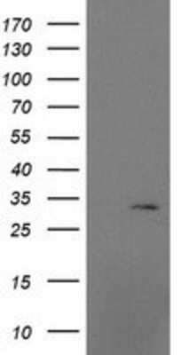 Western Blot: MRPS2 Antibody (OTI4D6) [NBP2-03292]