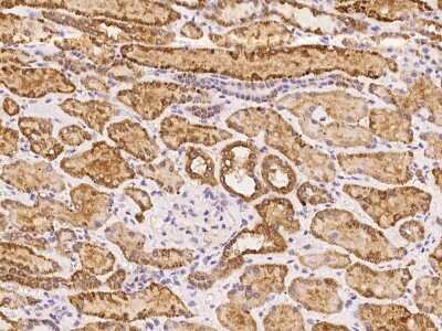 Immunohistochemistry-Paraffin: MRPS2 Antibody [NBP3-06045]