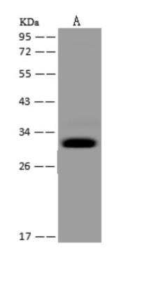 Western Blot: MRPS2 Antibody [NBP3-06045]