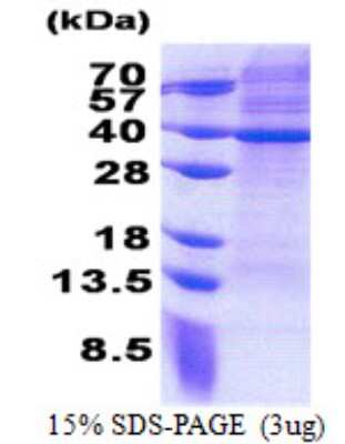 SDS-PAGE: Recombinant Human MRPS2 His Protein [NBP2-23242]