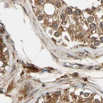 Immunohistochemistry-Paraffin: MRPS22 Antibody [NBP1-86788]