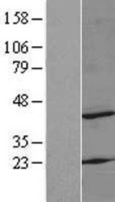 Western Blot: MRPS22 Overexpression Lysate [NBL1-13293]