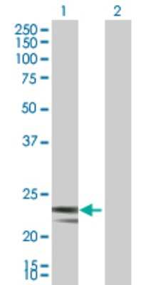 Western Blot: MRPS23 Antibody [H00051649-B01P]