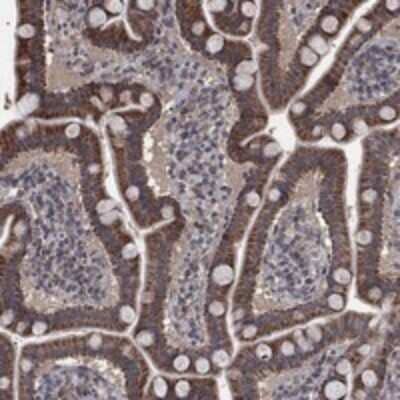 Immunohistochemistry-Paraffin: MRPS24 Antibody [NBP3-17603]