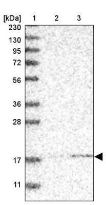 Western Blot: MRPS24 Antibody [NBP1-92140]
