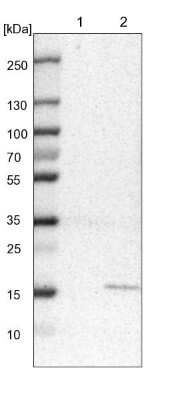 Western Blot: MRPS24 Antibody [NBP1-92140]