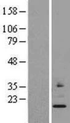 Western Blot: MRPS24 Overexpression Lysate [NBL1-13295]