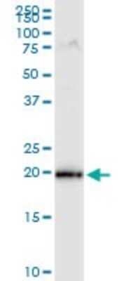 Western Blot: MRPS25 Antibody (3E6) [H00064432-M01]