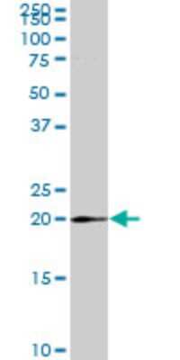 Western Blot: MRPS25 Antibody (3E6) [H00064432-M01]
