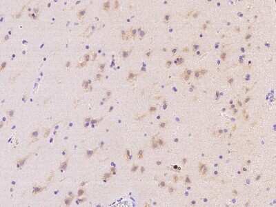 Immunohistochemistry-Paraffin: MRPS25 Antibody [NBP2-98523]