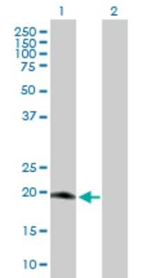 Western Blot: MRPS25 Antibody [H00064432-B01P]