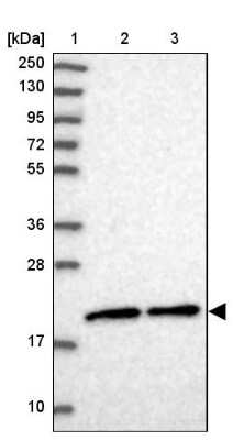 Western Blot: MRPS25 Antibody [NBP1-85151]