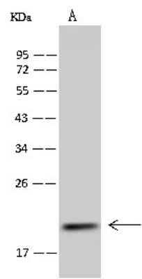 Western Blot: MRPS25 Antibody [NBP2-98523]