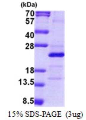 SDS-PAGE: Recombinant Human MRPS25 His Protein [NBP2-23243]