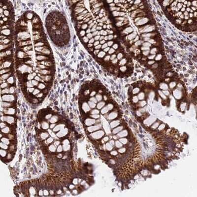 Immunohistochemistry-Paraffin: MRPS26 Antibody [NBP1-92141]