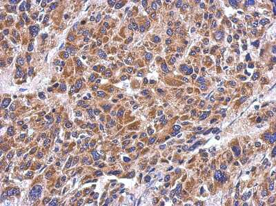 Immunohistochemistry-Paraffin: MRPS26 Antibody [NBP2-19413]