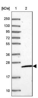 Western Blot: MRPS26 Antibody [NBP1-92141]