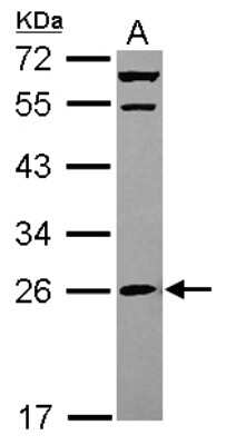 Western Blot: MRPS26 Antibody [NBP2-19413]