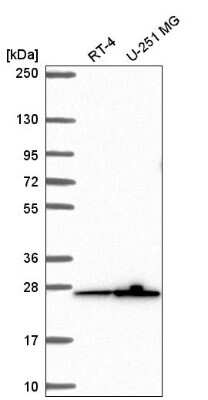 Western Blot: MRPS26 Antibody [NBP2-56855]