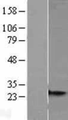 Western Blot: MRPS26 Overexpression Lysate [NBL1-13297]