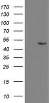 Western Blot: MRPS27 Antibody (OTI1A2) [NBP2-03888]