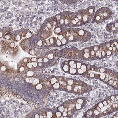 Immunohistochemistry-Paraffin: MRPS27 Antibody [NBP2-57774]