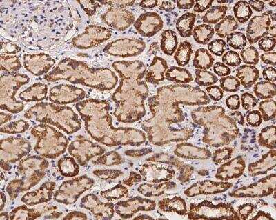 Immunohistochemistry-Paraffin: MRPS27 Antibody [NBP3-12687]