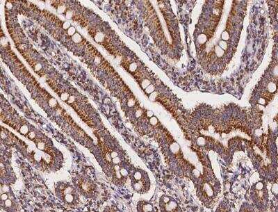 Immunohistochemistry-Paraffin: MRPS27 Antibody [NBP3-12687]