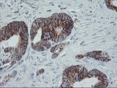 Immunohistochemistry: MRPS27 Antibody (OTI6E5) [NBP2-45938]