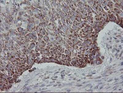 Immunohistochemistry: MRPS27 Antibody (OTI6E5) [NBP2-45938]