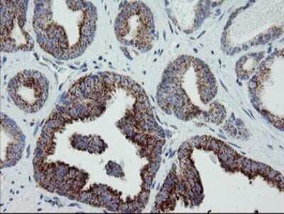 Immunohistochemistry: MRPS27 Antibody (OTI6E5) [NBP2-45938]