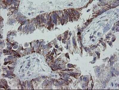 Immunohistochemistry: MRPS27 Antibody (OTI6E5) [NBP2-45938]