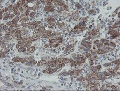 Immunohistochemistry: MRPS27 Antibody (OTI6E5) [NBP2-45938]