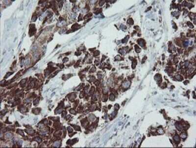 Immunohistochemistry: MRPS27 Antibody (OTI6E5) [NBP2-45938]