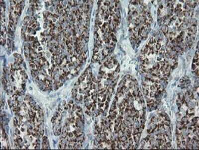 Immunohistochemistry: MRPS27 Antibody (OTI6E5) [NBP2-45938]