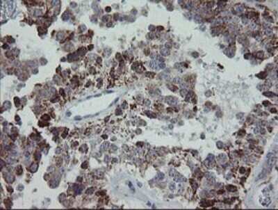 Immunohistochemistry: MRPS27 Antibody (OTI6E5) [NBP2-45938]