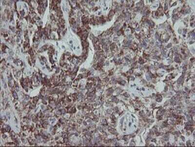 Immunohistochemistry: MRPS27 Antibody (OTI6E5) [NBP2-45938]
