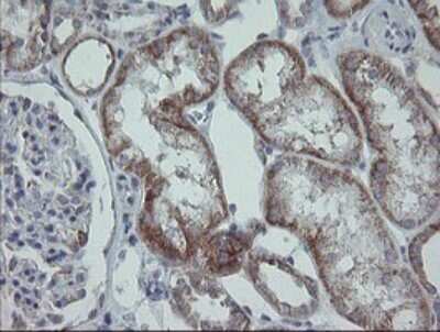 Immunohistochemistry: MRPS27 Antibody (OTI6E5) [NBP2-45938]