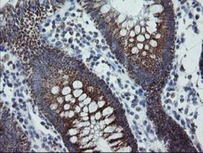 Immunohistochemistry: MRPS27 Antibody (OTI6E5) [NBP2-45938]