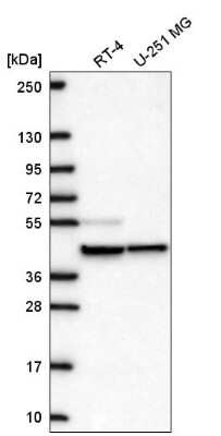 Western Blot: MRPS27 Antibody [NBP2-57774]