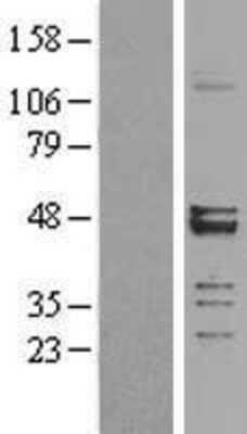 Western Blot: MRPS27 Overexpression Lysate [NBL1-13298]