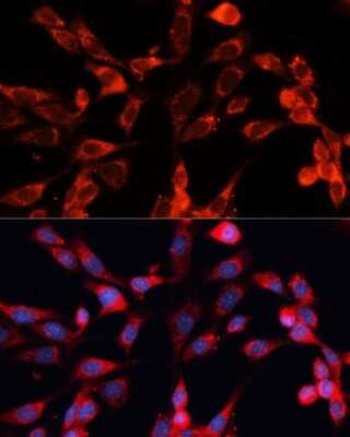 Immunocytochemistry/ Immunofluorescence: MRPS28 Antibody - Azide and BSA Free [NBP2-93219]