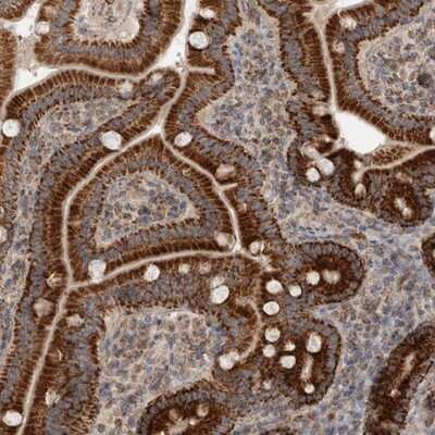 Immunohistochemistry-Paraffin: MRPS28 Antibody [NBP1-81685]